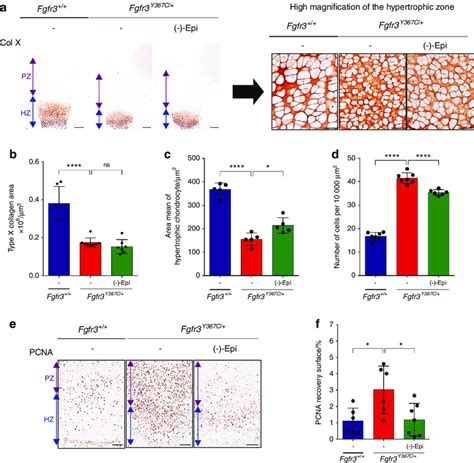 Epicatechin Modulates Hypertrophic And Proliferative Chondrocytes