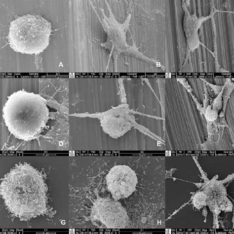 Pdf In Vitro Study Of Human Osteoblast Proliferation And Morphology