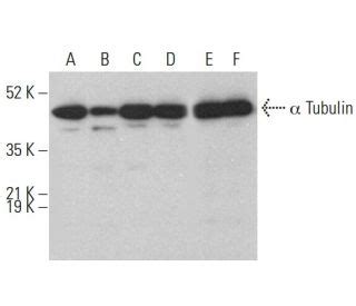 Alpha Tubulin Antibody B Scbt Santa Cruz Biotechnology