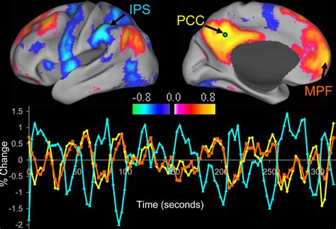 Frontiers Clinical Applications Of Resting State Functional Connectivity