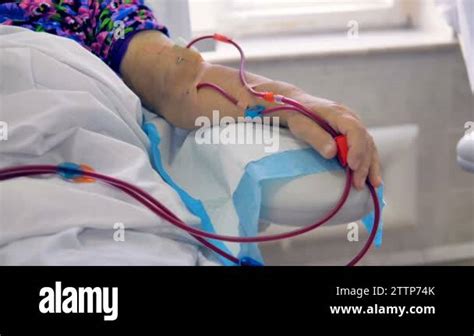 Blood Vessels Arm Stock Videos And Footage Hd And 4k Video Clips Alamy