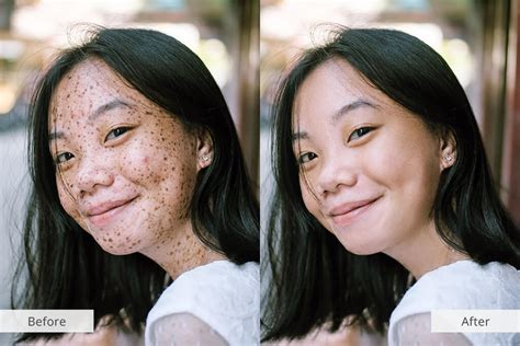 How To Hide Freckles Without Makeup Saubhaya Makeup