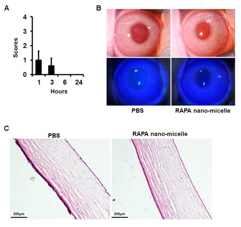 Rapamycin Nano Micelle Ophthalmic Solution Reduces Corneal Allograft Rejection By Potentiating