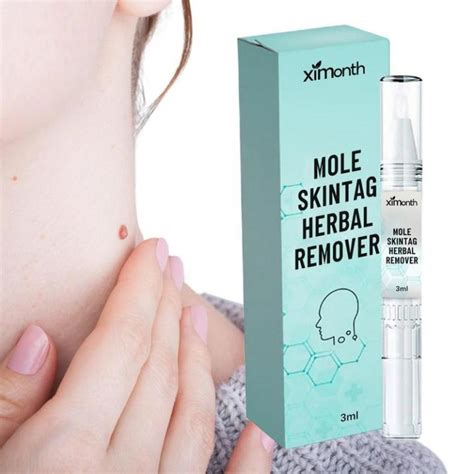 Ml Wart And Mole Remover Skin Tag Remover Skin Care Mole Remover