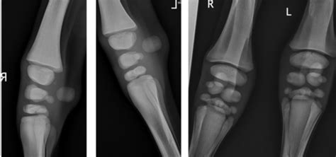 Neonate Orthopaedic Flashcards Quizlet