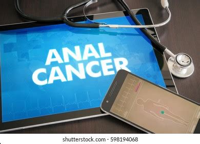 Im Genes De Anal Cancer Im Genes Fotos Y Vectores De Stock Shutterstock
