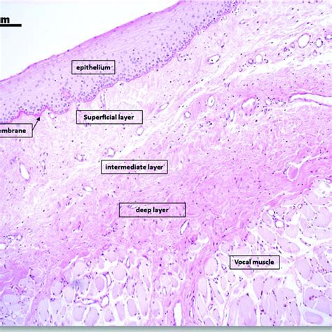 Human vocal fold. Stratified epithelium, delicate and continuous... | Download Scientific Diagram