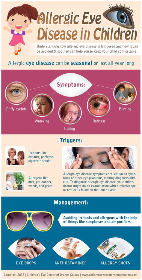 Allergic Eye Disease In Children Dr Golareh Fazilat Md Disease