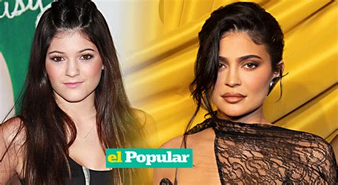 Kylie Jenner De Qu Operaci N Se Arrepiente Y Qu Problemas Tuvo Por