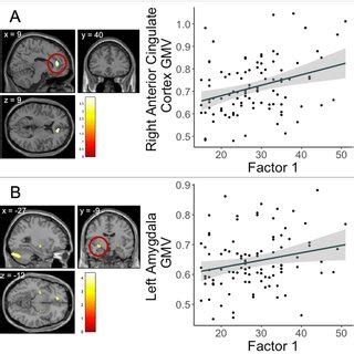 Cortical Region And Correlation Depicting Clusters In A The Left