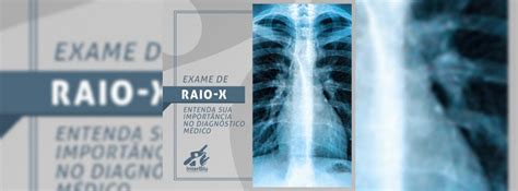 Exame De Raio X Entenda Sua Import Ncia No Diagn Stico M Dico