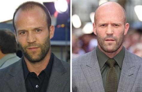 19 Bald Celebrities Before And After Embracing Baldness