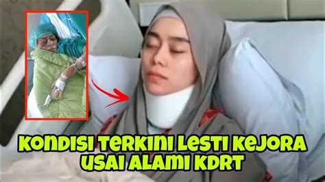 Sad S Kondisi Terbaru Lesty Kejora Usai Alami Kdrt Wajah Bengkak