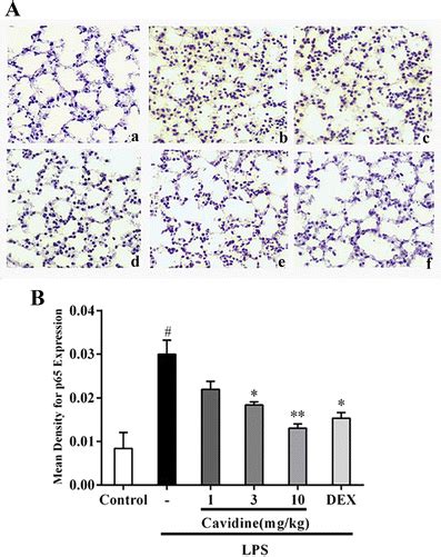 The Effect Of Cavidine On Nf κb P65 From Lps Induced Ali Mouse Lung By