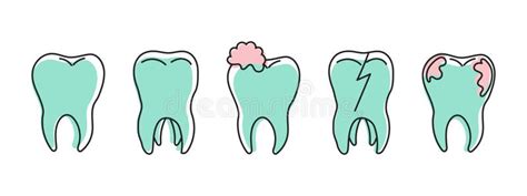 Healthy And Unhealthy Teeth Teeth With Caries Tartar Dental Care