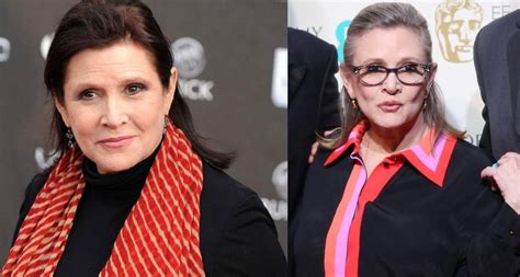 Carrie Fisher Plastic Surgery Before And After Cosmetics Pictures ...