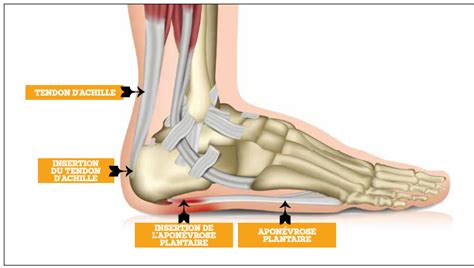 Résumé de 28+ articles sur le sujet : douleur talon que faire [récemment mis à jour] - france ...