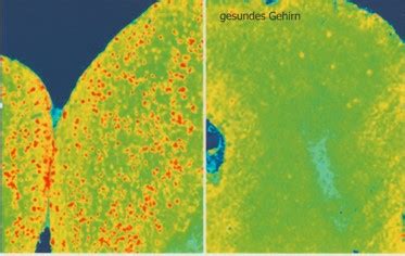 Gesund Sein Und Gesund Bleiben Mit Epigenetik Epigenetik Und Gesundheit