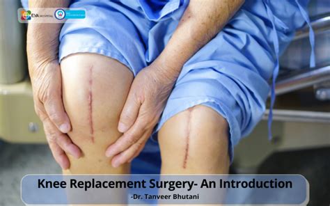 Total Knee Replacement Recovery Timeline Eva Hospital