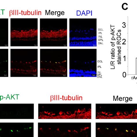 Levels Of P Akt In The Retinas Of Rats With Elevated Iop Overexpressing