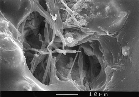 432 7 Sem Image Showing Fungal Hyphae Penetrating A Pore Download