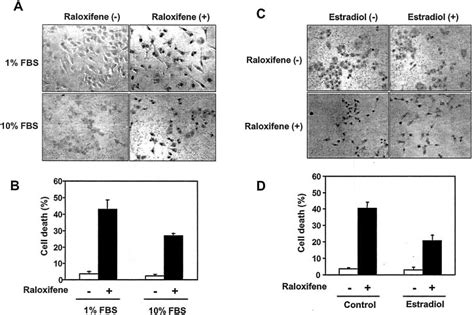 Induction Of Apoptosis By Raloxifene In A Tsu Pr1 Cell Line A Tunel