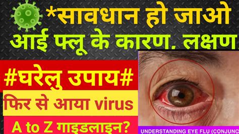 Eye Flu Conjunctivitis Myths Causes Symptoms आई फ्लू के लक्षण