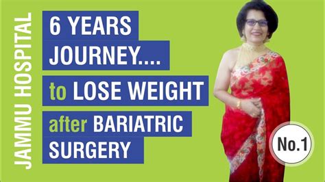 Mini Gastric Bypass Surgery In India Years Journey To Lose Weight