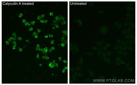 Phospho Gsk3b Ser9 Antibody Cl488 67558 Proteintech 武汉三鹰生物技术有限公司