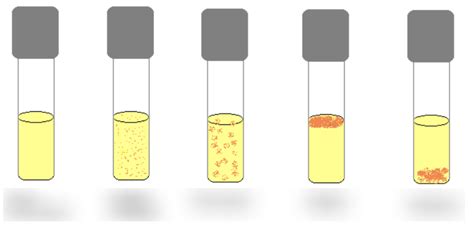 Bacterial Growth Patterns In Broth Diagram Quizlet