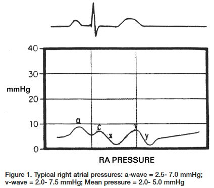 Hemodynamic Monitoring Flashcards Quizlet