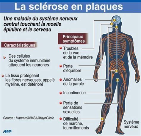 La Scl Rose En Plaque Sep