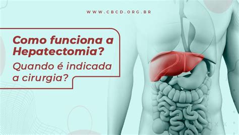 Como funciona a Hepatectomia Quando é indicada a cirurgia CBCD