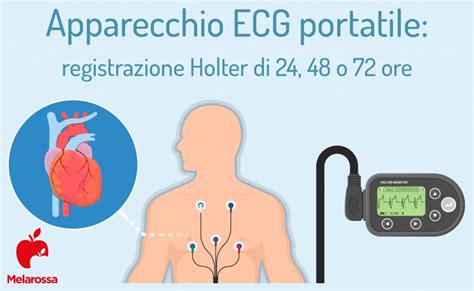 Elettrocardiogramma Che Cos Come Funziona E Cosa Si Vede