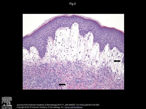 Edidiong Celestine Ntuen Kaminska Md Mbs Adaobi I Ppt Download