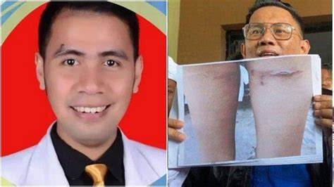 Biodata Raja Dokter Forensik Pembela Guru Supriyani Yang Bongkar Luka