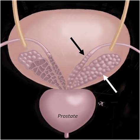 Seminal Vesicle Diagram