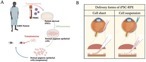 Ijms Free Full Text Pluripotent Stem Cells In Clinical Cell