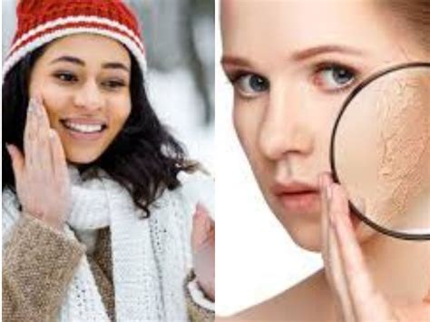 Winter Dryness: जाड़ों में त्वचा की खुश्की से हैं परेशान, तो ये 5 उपाय ...