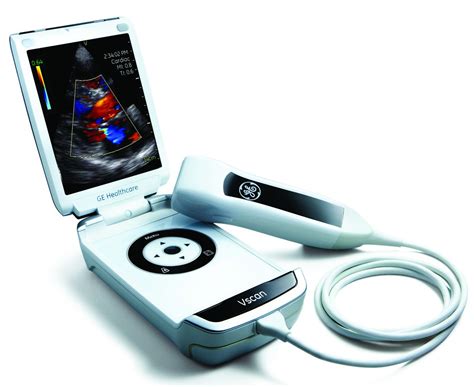 technology  sonography vscan    handheld ultrasound