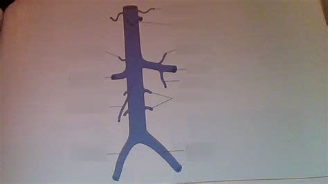 Chapter 11 Inferior Vena Cava Diagram Quizlet