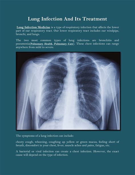 PPT - Lung Infection And Its Treatment PowerPoint Presentation, free ...