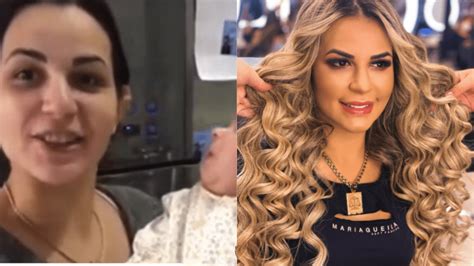 Deolane Bezerra Surpreende Com Antes E Depois Impressionante Sbt