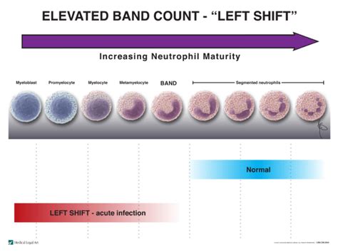 Neutrophil Left Shift – Snellustrations