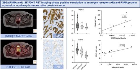 Consecutive Prostate Specific Membrane Antigen Psma And Antigen