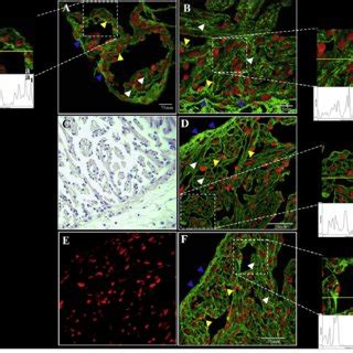 Representative Confocal Images Of ENOS Immunolabeling On Atrial A And