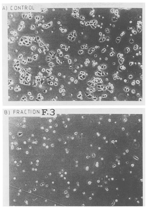 NHIK 3025 Cells In Culture Flasks 48 H After Elutriation A An