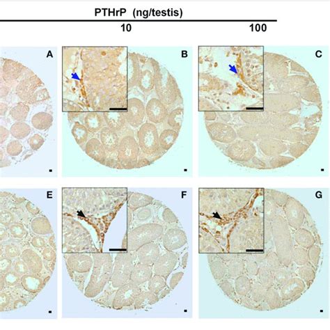 Pthrp Induces Stem Leydig Cell Differentiation In Vitro Scheme Of