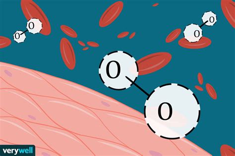 Overview and Types of Hypoxia