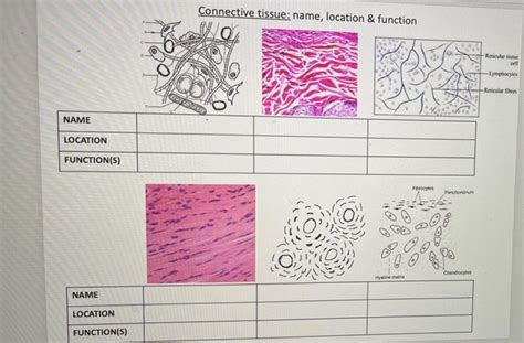 Solved Connective tissue: name, location & function | Chegg.com